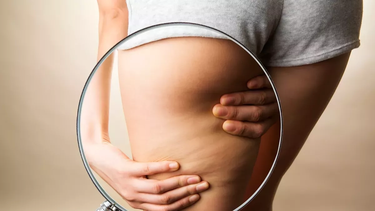 10 conseils pour gommer la cellulite des cuisses