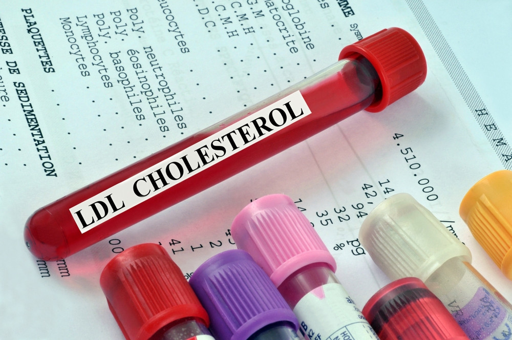 Cholestérol : quand et pourquoi faire un bilan lipidique ?