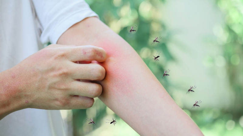 Comment savoir si je fais une allergie aux piqûres de moustiques ?