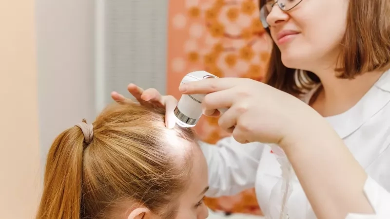 La teigne : causes, symptômes, traitements et prévention