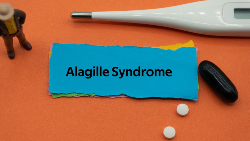 Le syndrome d’Alagille : un aperçu complet