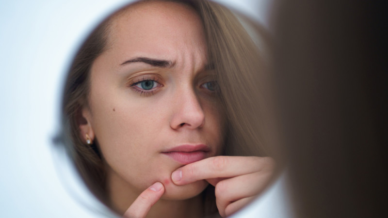 Comment se débarrasser d’un bouton de stress ?