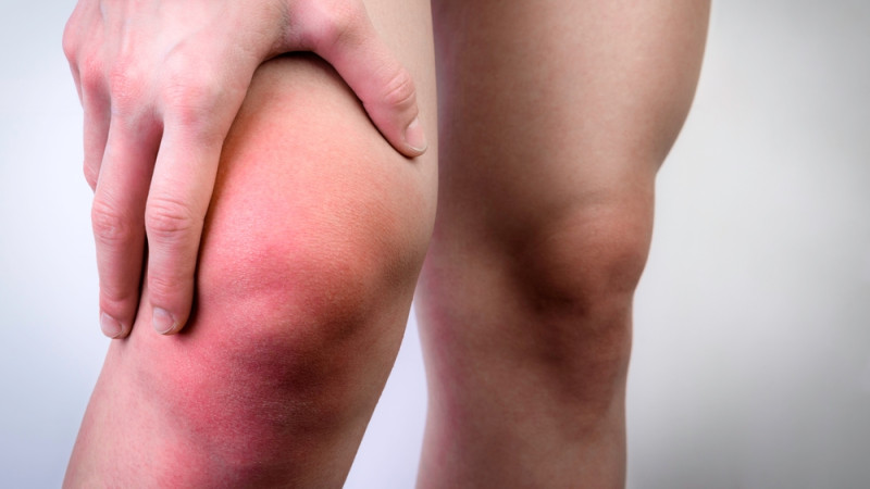 10 conseils pour soulager les jambes gonflées