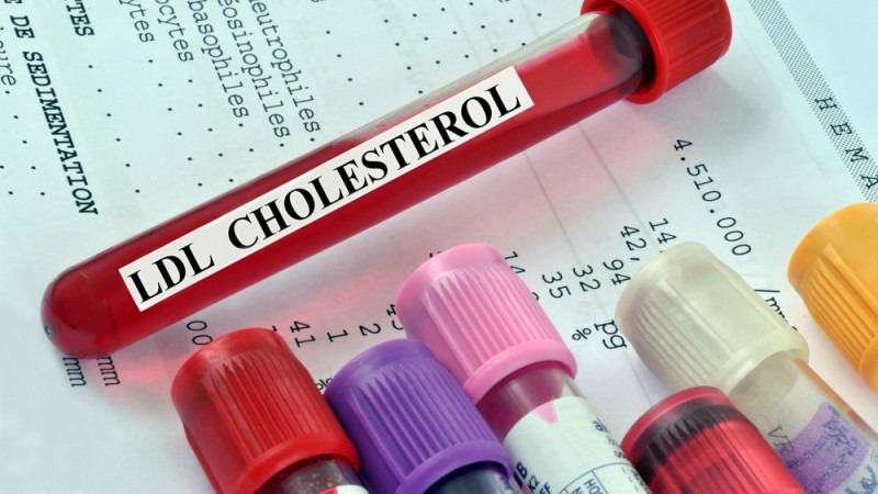 Cholestérol : quand et pourquoi faire un bilan lipidique ?