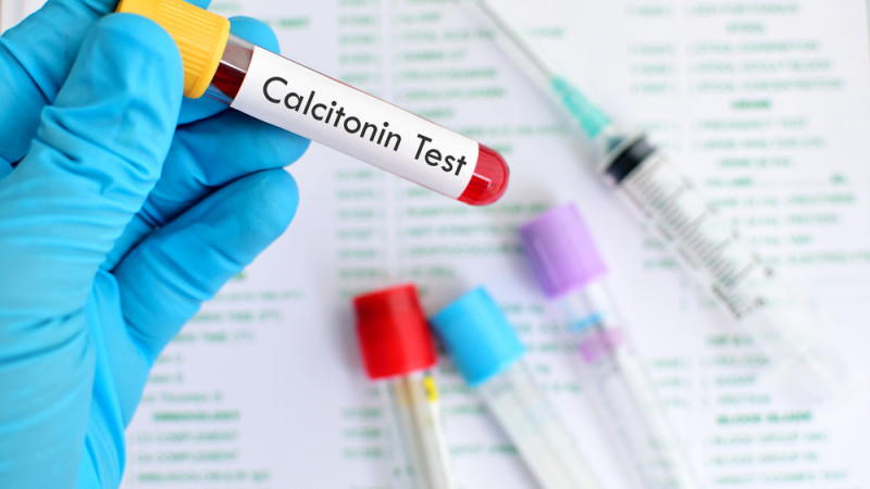 Qu'est-ce qui fait augmenter la calcitonine ?