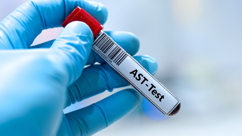 Transaminases élevées : quand s’inquiéter ?